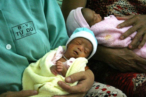 4 cô "công chúa" được hạ sinh hôm 20/6, với sự can thiệp kịp thời của êkíp bác sĩ Bệnh viện Phụ sản Từ Dũ. Trong ảnh: Công chúa’ nặng ký nhất cân được 1,7 kg khi sinh